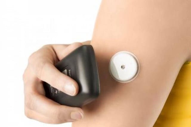 monitoring glyukozy